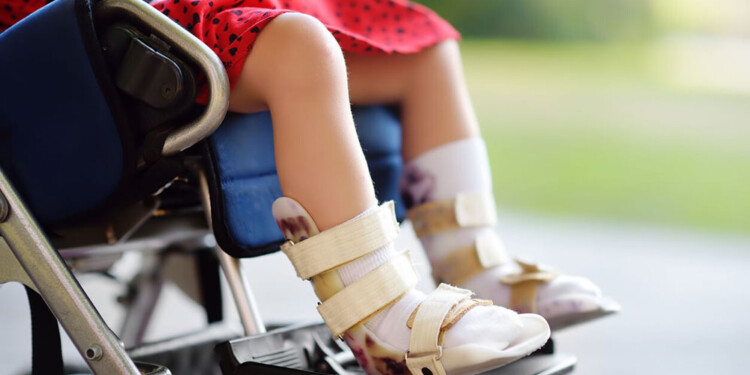 ATROFIA MUSCULAR ESPINAL. Es una de las enfermedades de origen genético que pueden mejorar su condición con diagnósticos certeros a temprana edad.