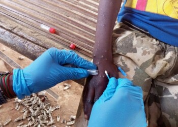 La viruela del mono, según Médicos sin Fronteras: ¿Estamos ante una nueva pandemia?