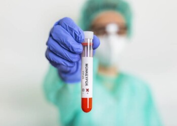 Viruela del mono: algunas de las principales dudas con respecto al mpox