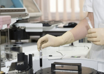 “El 13,5% no rendido por la UNaM corresponde a fondos asignados que nunca llegaron”