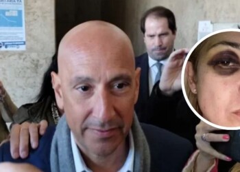 El ex médico presidencial declaró que vio el moretón en el ojo de Fabiola Yañez