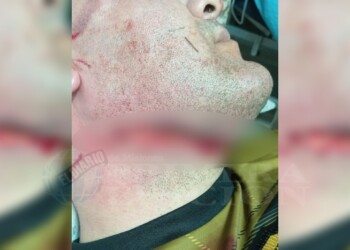 Un lesionado grave en el empate de Tuyutí y Sol de Mayo