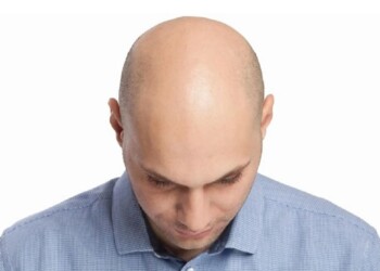 Hoy es el Día Mundial del Pelado: por qué y para qué