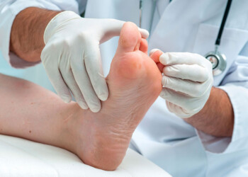 “Entre el 20 y 30% de las personas con diabetes tendrá una úlcera en sus pies”