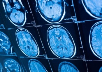 Qué es la Corea de Huntington, de la que hoy se conmemora el Día Mundial