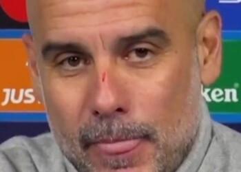 Virales: Pep Guardiola terminó lleno de arañazos el partido de Champions