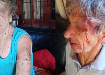 Video: así escapaban los presuntos autores de la feroz golpiza a una pareja de jubilados