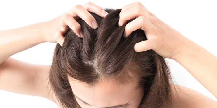 Closeup woman hand itchy scalp Hair care concept