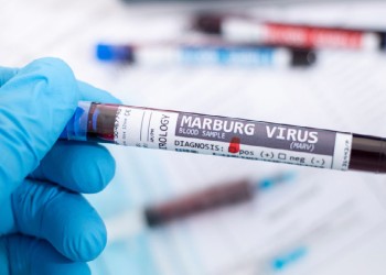 Murieron ocho personas por un posible brote del virus de Marburgo en Tanzania