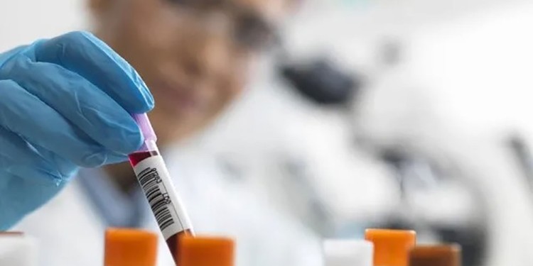 DIAGNÓSTICOS. En la provincia hay un promedio de 100 a 160 casos nuevos por año, con mayor incidencia en personas de entre 22 y 28 años.