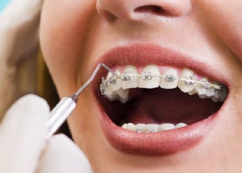 Alertan sobre productos cosméticos y odontológicos “truchos”