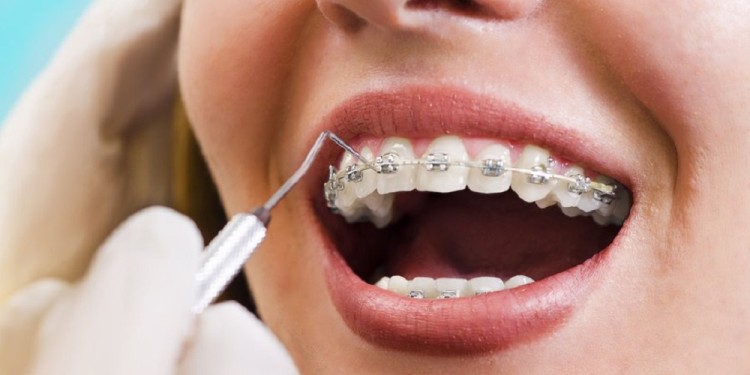 (Imagen ilustrativa)