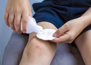 Ni algodón, ni alcohol, ni agua oxigenada: ¿cuál es el mejor remedio para las heridas?