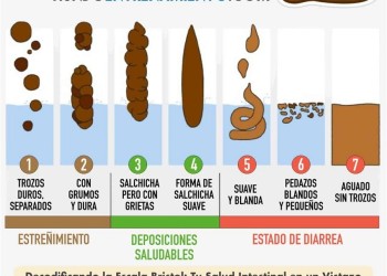 Un autoestudio de características