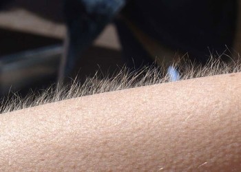 ¿Por qué aparece la “piel de gallina”?