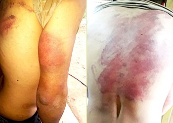 Dos policías de Irigoyen a juicio oral por “privación ilegítima de la libertad y torturas”