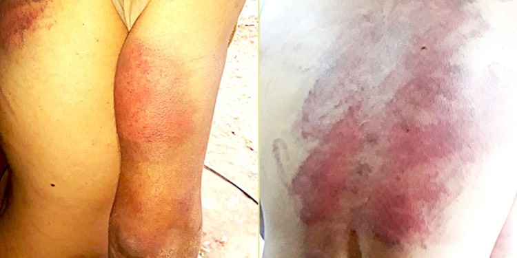 VIOLENCIA EXTREMA. Los rastros de la golpiza.