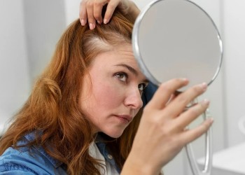 ¿Se te cae el cabello?