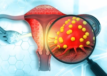 Cáncer de cuello uterino: con un 50% de mortalidad, la prevención es fundamental