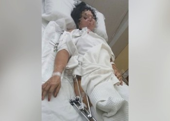 Fue atropellada y busca al responsable que huyó en auto: “Me pasó por encima y me dejó ahí”