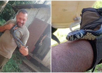 “El torniquete no sirve en una mordedura de serpiente, puede provocar necrosis”