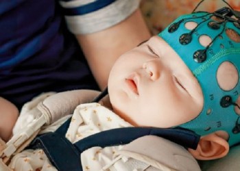 Síndrome de West: sus causas y su impacto