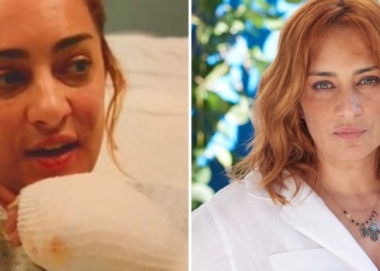 Cómo está la salud de María Julia Oliván tras quemarse el 25% del cuerpo