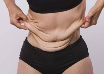 “Bisturí con derechos”: guía legal