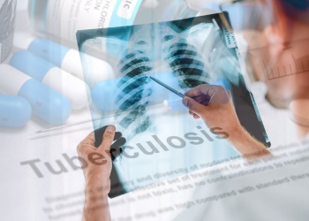 Alarma por el aumento de casos de tuberculosis en Argentina