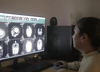 El Hospital Madariaga realiza cirugías especializadas para epilepsia severa