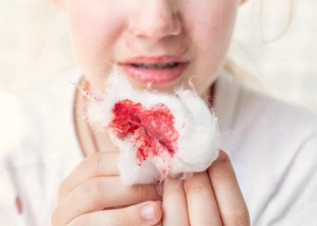 Hemofilia: hay 35 pacientes de la provincia en el Programa Incluir