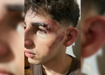 “Fue un intento de homicidio”: denuncian una “brutal golpiza” por parte de “patovicas” en Posadas