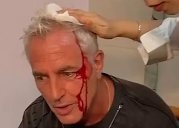 Marley sufrió un accidente mientras filmaba en las catacumbas de Tailandia