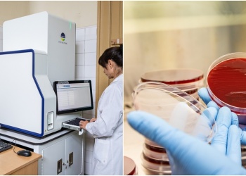 Maldi-Bot: la inteligencia artificial argentina que revoluciona el diagnóstico microbiológico