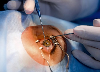 El INCUCAI lanza plan de emergencia para redistribuir córneas y reducir las listas de espera