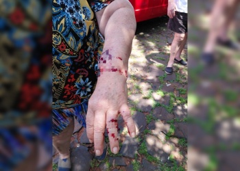 Violentos ataques de pitbulls en Posadas dejaron dos mujeres hospitalizadas