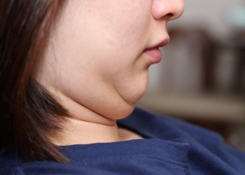 Qué dice el tamaño del cuello sobre tu salud