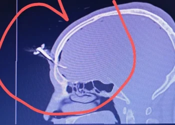 Salvaje ataque en un torneo de fútbol: le clavaron una llave en la cabeza a un exfutbolista