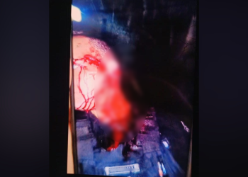 Un policía casi pierde la oreja tras ser atacado por un hombre violento en Garupá