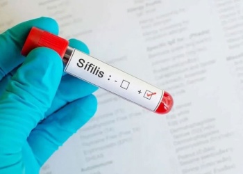 “Estamos en alza”: Misiones confirma el aumento de sífilis y advierten falta de campañas