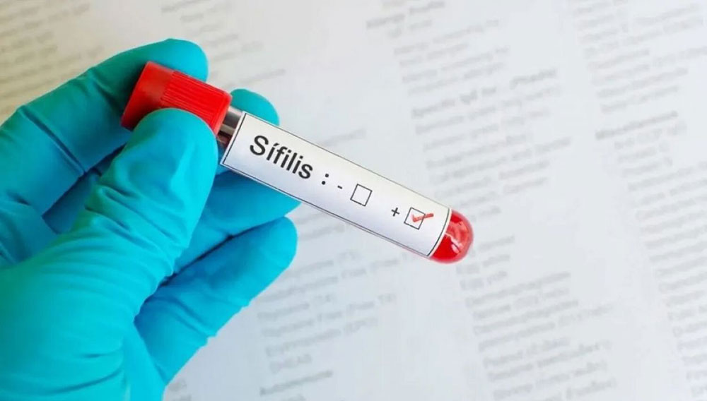 “Estamos en alza”: Misiones confirma el aumento de sífilis y advierten falta de campañas