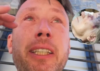 Atacaron a la abuela de un influencer que denuncia irregularidades en suplementos nutricionales