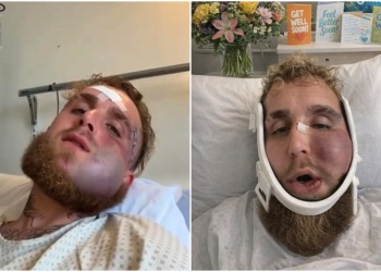 Jake Paul mostró su rostro a cinco días del brutal nocaut de Anthony Joshua