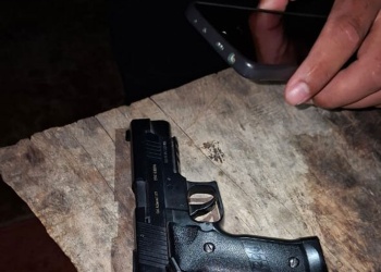 Un niño de 12 años podría perder un ojo tras un disparo accidental