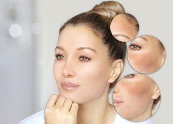 Piel sensible Descubre cómo tratarla