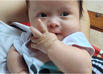 Oliver necesita una cirugía urgente para no perder la visión