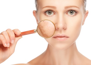 Skincare con Sentido: manchas en la piel