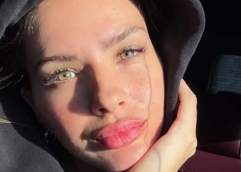 La China Suárez mostró el resultado de un lifting y causó sorpresa en redes