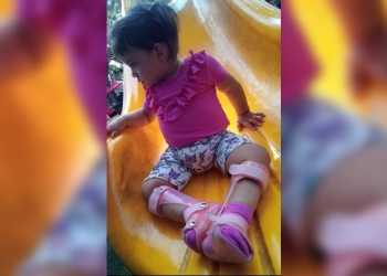 Campaña solidaria: la pequeña Emma Olivia necesita un bipedestador para poder caminar