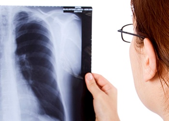 Argentina reportó un aumento del 80% de  tuberculosis en los últimos cinco años